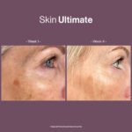 SKIN ULTIMATE - Image 2