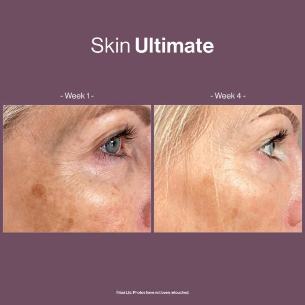 SKIN ULTIMATE - Image 2