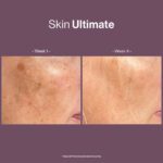 SKIN ULTIMATE - Image 3