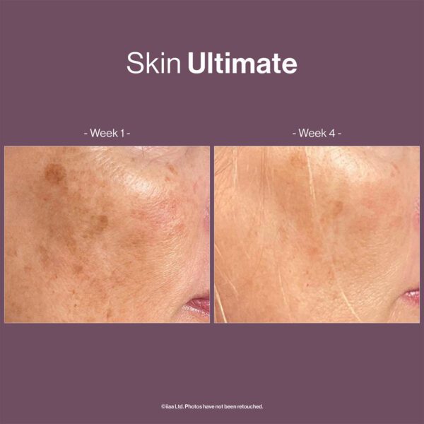 SKIN ULTIMATE - Image 3