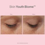 SKIN YOUTH BIOME™ - Image 5