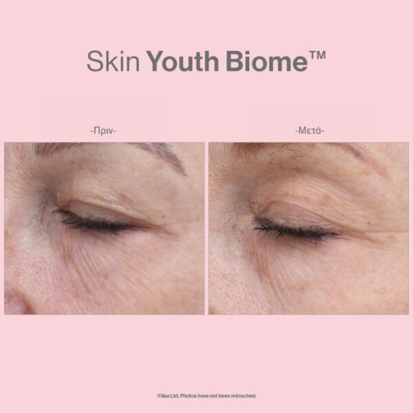 SKIN YOUTH BIOME™ - Image 6