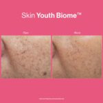 SKIN YOUTH BIOME™ - Image 7