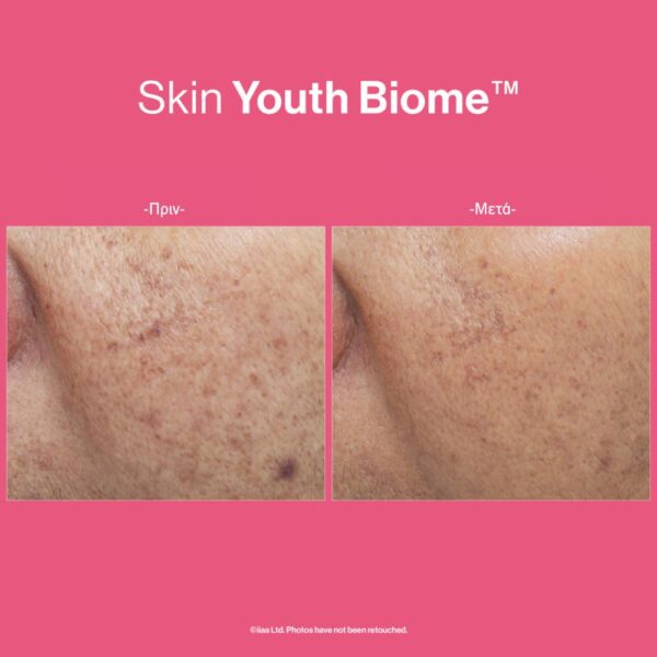 SKIN YOUTH BIOME™ - Image 7