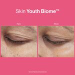 SKIN YOUTH BIOME™ - Image 8