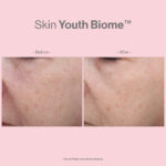 SKIN YOUTH BIOME - Image 6