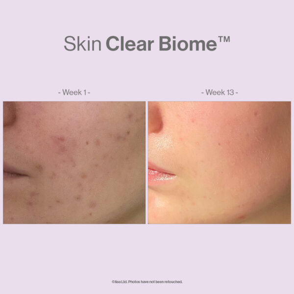 SKIN CLEAR BIOME - Image 8