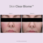 SKIN CLEAR BIOME - Image 9