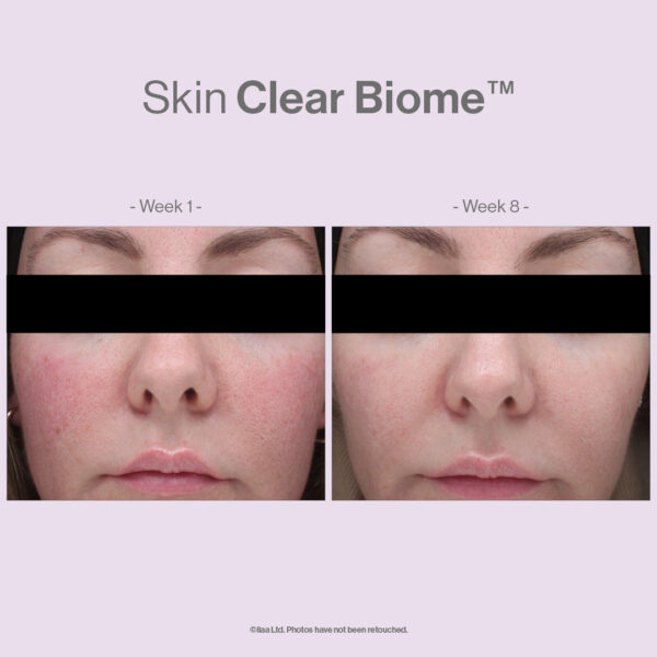 SKIN CLEAR BIOME - Image 9