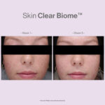 SKIN CLEAR BIOME - Image 10