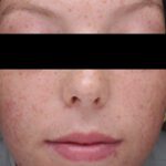 SKIN CLEAR BIOME™ - Image 6