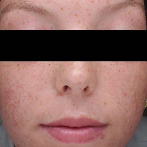 SKIN CLEAR BIOME™ - Image 5