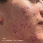 SKIN CLEAR BIOME - Image 5