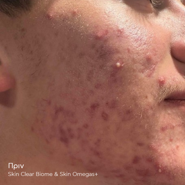 SKIN CLEAR BIOME - Image 5