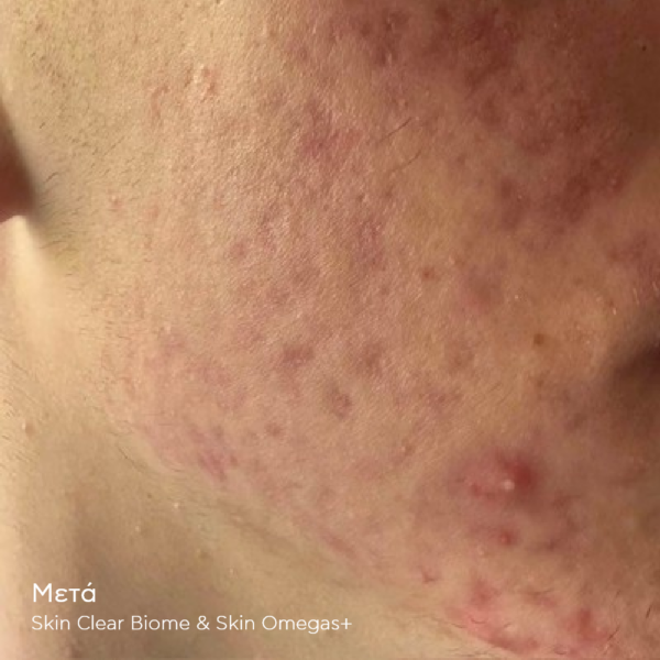 SKIN CLEAR BIOME - Image 6