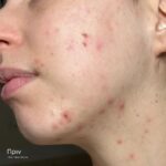 SKIN CLEAR BIOME - Image 3