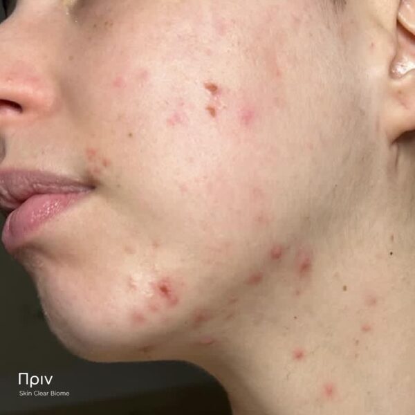 SKIN CLEAR BIOME - Image 3