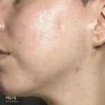 SKIN CLEAR BIOME - Image 4