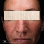 SKIN MOISTURE IQ - Image 2