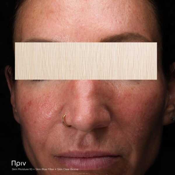 SKIN MOISTURE IQ - Image 2