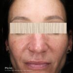 SKIN MOISTURE IQ - Image 3