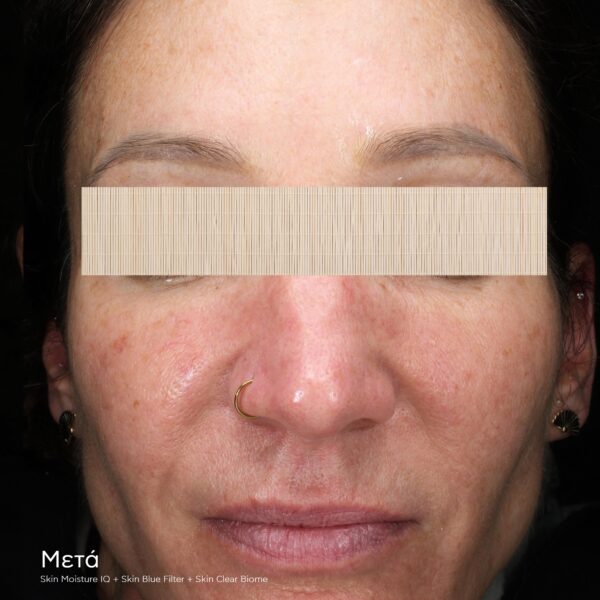 SKIN MOISTURE IQ - Image 3