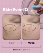 SKIN EVEN IQ - Image 4