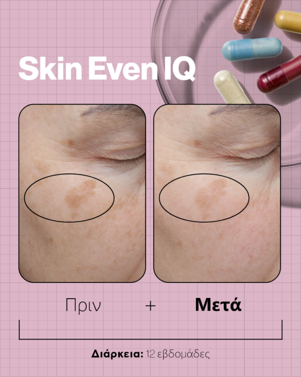 SKIN EVEN IQ - Image 4