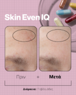 SKIN EVEN IQ - Image 6