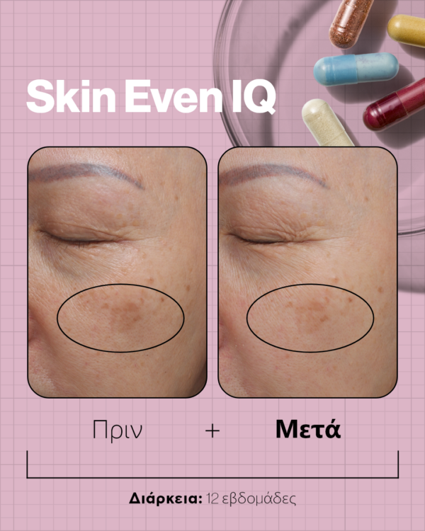 SKIN EVEN IQ - Image 8