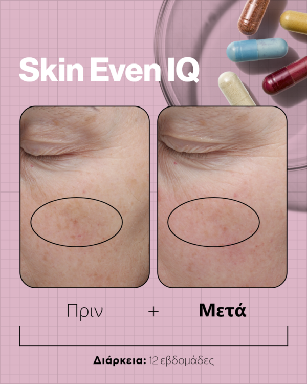 SKIN EVEN IQ - Image 9
